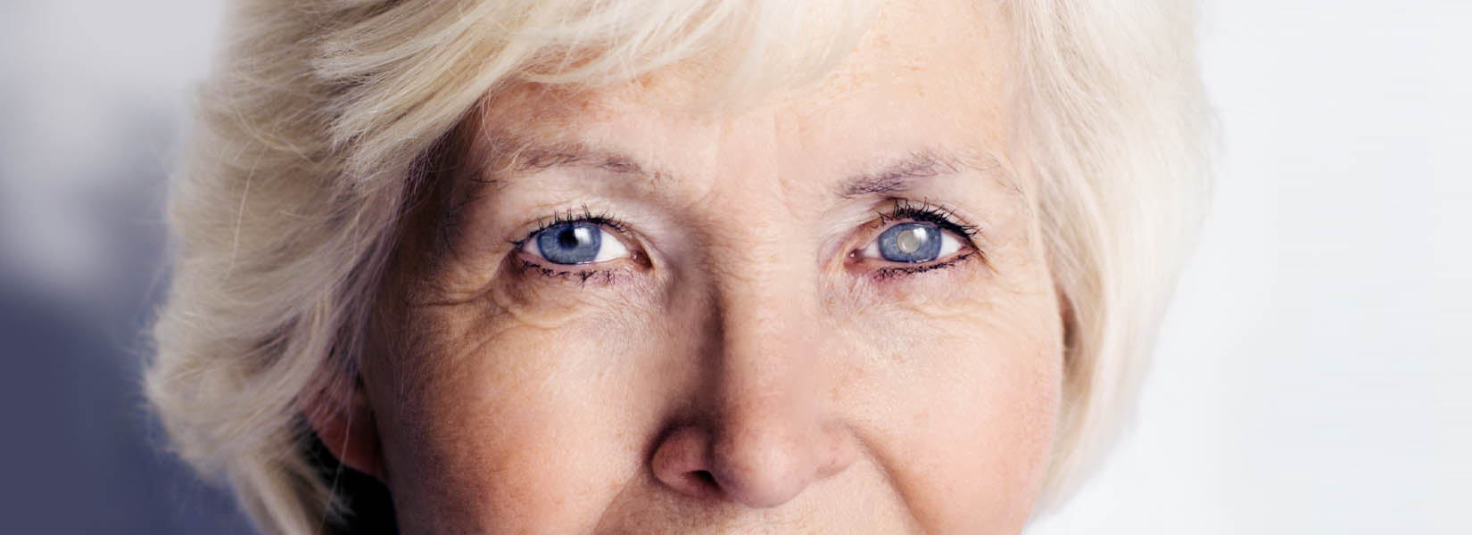 Cataract Surgery in Savage